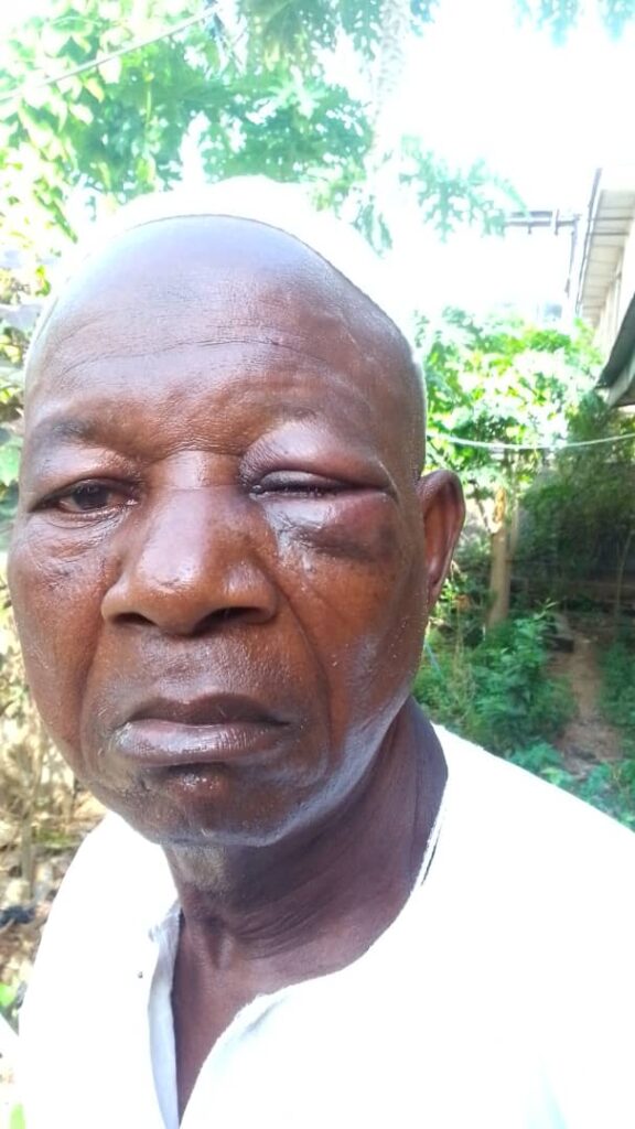 LG Chairmanship Aspirant Batters 79-yr old Landlord over Non-Compliance with Environmental Sanitation’s Laws in Lagos